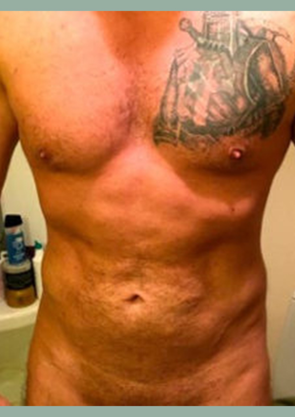 Lipo-corps017-2