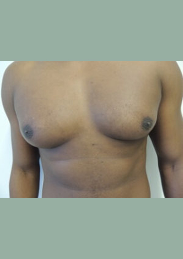 Lipo-corps018-1