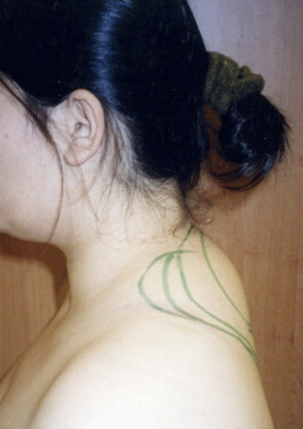 Lipo-corps032-1